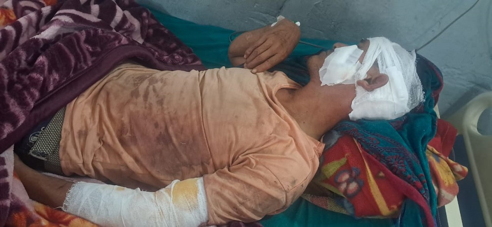 अछाममा बाघको आक्रमणबाट एक जना गम्भीर