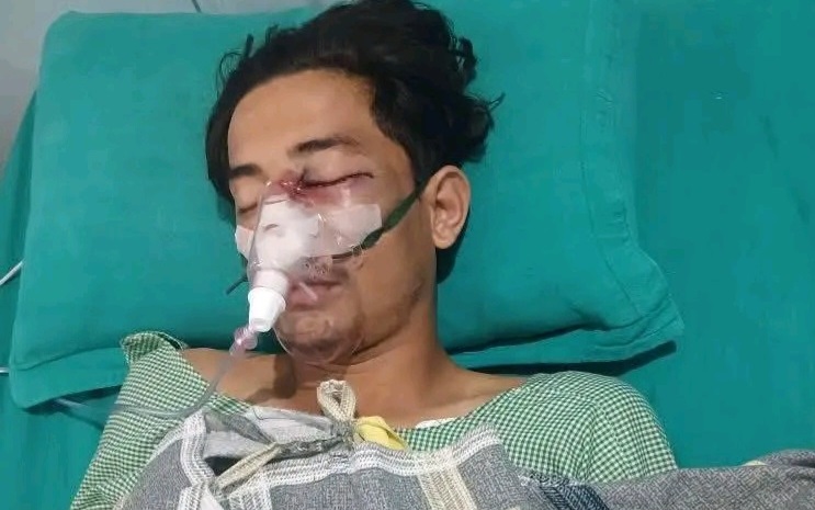 कञ्चनपुरको बेलौरीमा खेलाडीमाथि निर्घात कुटपिट