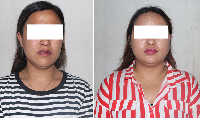 हनी ट्र्यापमा पारेर रकम असुलेको आरोपमा कैलालीको गोदावरीकी युवती पक्राउ