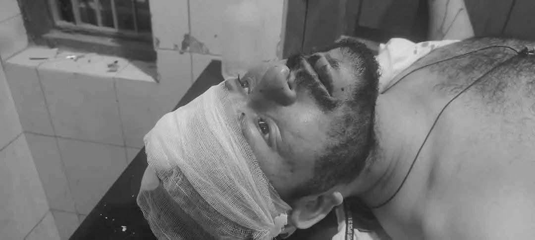 टीकापुरको क्याफेमा कफी पिइरहेका युवकमाथि खुकुरी प्रहार, कोहलपुर रेफर